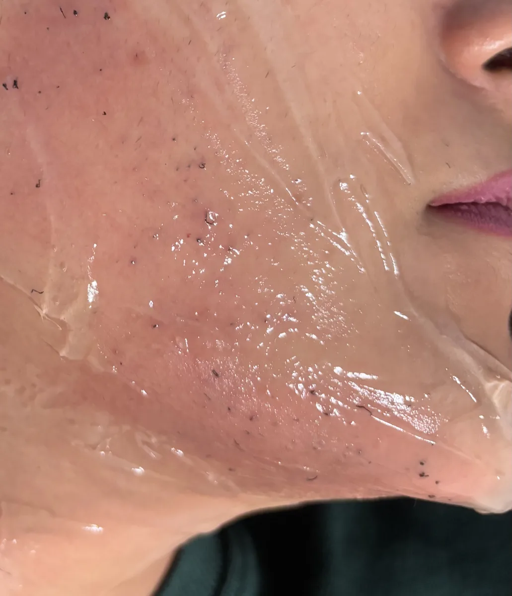Clinix Quatrix Treatment Result 8